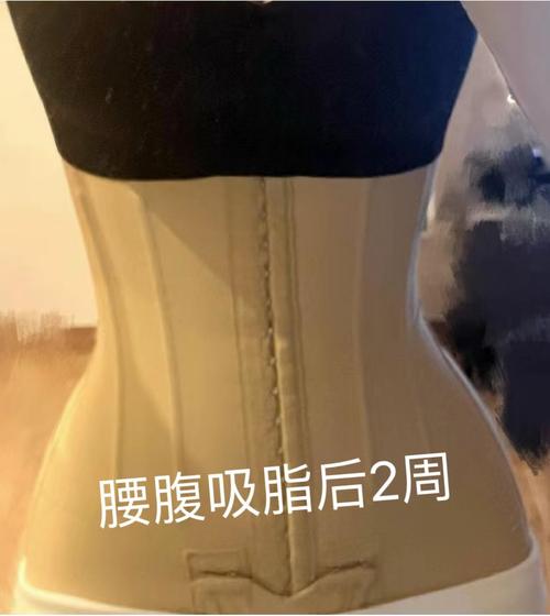 苏州腰腹环吸选哪家？美贝尔、薇琳、维多利亚对比来了